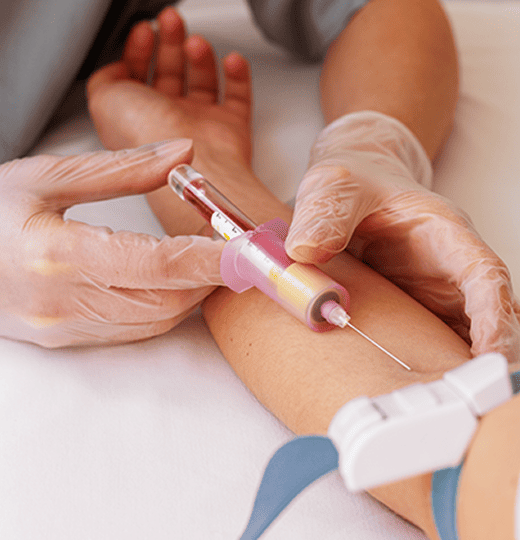 Blood test sample
