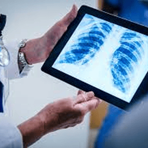 Chest Imaging