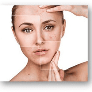 Dermatology