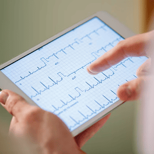 ECG