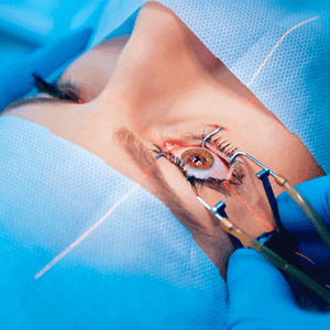 retina care