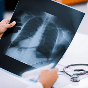 X-Ray